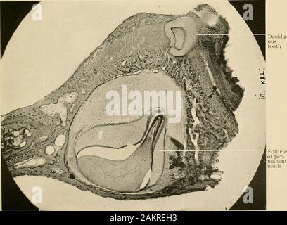 Grundsätze und Praxis der Operative Zahnheilkunde. Follikel ofpermanent Zahn Abb. 213.-vertikalen Abschnitt der Kiefer von Embryo Katze, mit Laub- Zahn und follikel von bleibenden Zahn. : &Lt; 90.. Abb. 21-1.-Oblique Abschnitt der Kiefer von Embryo Essen, mit Laub- Zahn und die Follikel nermanent Zahn. X SO. Stockfoto