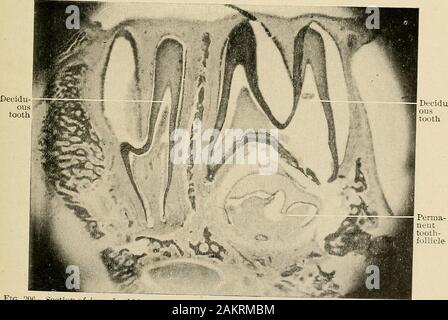 Grundsätze und Praxis der Operative Zahnheilkunde. Abb. 205.-vertikalen Abschnitt von tlie Kiefer, zeigen die Wurzel, v 15.. Perma-nenttooth - follikel Abb. 206.- Abschnitt der Kiefer von Kaninchen, die Milchzähne und Haarfollikel der bleibenden Zähne ur sUu bei theperiod der Eruption des primären Zähnen. X 22. Stockfoto