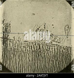 Grundsätze und Praxis der Operative Zahnheilkunde. Odonto-blasten, attachedto formeddentin Dentin Abb. 169.- Neckte Abschnitt der Entwicklung der Molaren, zeigt die Odontoblasts und deren Prozesse. (V. A. Latham.) X1000. Fibrille Zelle. Abgeschnitten Odon - showingspherule ofcalcoglobulin toblasts, Abb. 170.- Abgeschnitten odontoblasts und fibrilläre Zellen. (R. R. Andrews.) HISTOLOGIE DER ZAHNMEDIZINISCHEN Gewebe. 55 Ein einzelner Prozess, aber während der aktiven Phase der Entwicklung der Zellen areflat und breit, oder abgeschnitten werden am Ende auf die Bildung von Dentin (Abb. geleitet. 170). Während dieser Zeit der Odontoblasts häufig vorhanden Stockfoto