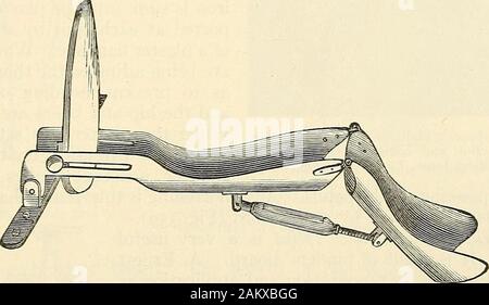 Die moderne Chirurgie, allgemeine und operative. ar des Rahmens, und ziehen Sie den Rahmen von Seilen (Abb. 355). Hodgensapparatus wie von Braun, von Birmingham, Ala angewendet wird, ist eine der am meisten satis-factory Methoden der Behandlung in Fraktur unter das obere Drittel. Die extremitycan angehoben oder abgesenkt werden, ohne die Angleichung der thefragments, Erweiterung der erforderliche Grad gewonnen werden können, und der patientcan im Bett bewegt werden. Ich halte dieses Gerät eine der am meisten comfortableappliances, die getragen werden können und ausgezeichnete resiilts sind durch ihre Nutzung erhalten. Infracture im mittleren Drittel o Stockfoto