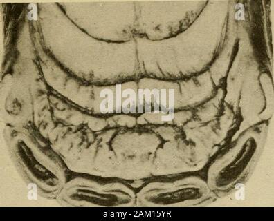 Veterinär Hinweise für Pferdebesitzer: Handbuch Pferd der Medizin und Chirurgie. Abb. 218 - Vordere Ansicht der Schneidezähne (Nat.-Größe). Mund auf 6 Monate. 707. Stockfoto