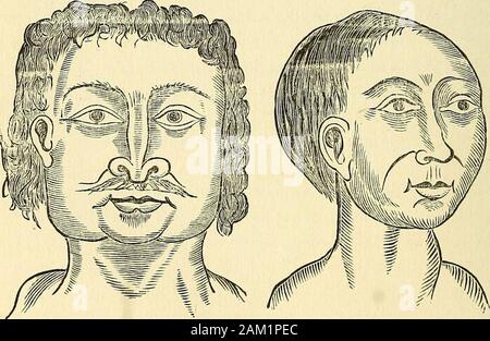 Natur die Enthüllungen von Charakter; oder, physiognomie illustratedA Beschreibung der geistigen, moralischen und volitive Dispositionen der Menschheit, wie in der menschlichen Form manifestiert und schaut. ) Abb. 6. - ein Moskauer Menschen. Fisc. 7. einen indischen. Vor zweihundert Jahren, es waren Männer im Alten Hafen, in den West Indies, die eine quadratische Form des Kopfes byartificial bedeutet kultiviert. Wenn das Kind noch jung war, sie verwendet. Abb. 8.- ein West Indiaman. Abb. 9.- ein griechischer Mann. Boards an den Seiten und auch Holzkisten zu inclose theskull, bis die Natur nicht nur die Form in der Art und Weise erhalten; ODER, MAN VERFORMT DURCH ARTIFI Stockfoto