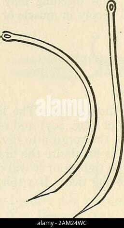 Die moderne Chirurgie, allgemeine und operativen. Abb. 208.- Methode der Chirurgen Knoten binden. 440 Krankheiten und Verletzungen des Herzens und der Gefäße Adern sind als sind Arterien ligiert. Wenn eine große Vene zerrissen ist, wünschen wir, wenn möglich, Blutungen ohne auslöschung das Lumen der Vene durch Ligation zu steuern. Abb. 2 og.-^ Hagedorns Nadeln. Stockfoto