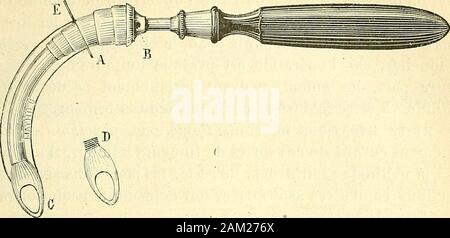 Chirurgie journalière des Hopitaux de Paris: Répertoire de thérapeutique chirurgicale. Édé classique 1611 depuis Lange-temps et Bien réglé par Trousseau et Guersant: Il ny Eine pas lieu, même Chez ladulte, Davoir à redouter lhémorrhagie. Les pinces, dites hémostatiques, quon appliquées laisse Sur Le Vaisseau pen-ter un temps mehr oder weniger lang, suffisent à arrêter lécoulement. Quant à louverture de la trachée, Elle doit être Faite, de toute Né-cessité, avec linstrument Tranchant et agrandie, Sil est besoin, Avecun bistouri boutonné. M. A. Després ne se sert pourlintroduction généralement de la c Stockfoto