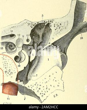 "Traité d'anatomie humaine. Abb. 419. Coupé vertico-Transversale du lemporal Passant par lextrémité antérieure de La fenêtre Ronde ein, Segment postérieur De la Coupe, montrant La paroi postérieure de la Caisse du tympan B, Segment antérieur De la Coupe, montrant La paroi antérieure de la Caisse. X - 1, Kabelkanal auditif externe. - 2, Sulcus tynipanicus. - 3, Drossel dentrée de la Corde du tympan. - 4, sinustjnipaui. - 5, pjramidc. - 6, protubérance styloïde. - 6, apophyse stloïde. - 7, rigole inférieure de la Caisse. - S. paroi interne de la Caisse (promontoire). - Il, fenêtre ovale. - 10, Rampe Stockfoto