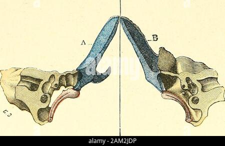 "Traité d'anatomie humaine. Le Toit et le plauctier de la Caisse, vussur une Coupé vertico-Transversale. pour montrer Mehrfachrapport avec leurs lecerveau et le Golfe de la jugulaire. 1. Bord antérieur de rorifice du Conduit audi-tif externe. - 2, Conduit auditif externe. -&Gt;!, Sulcus tympanicus. - 4, paroi Supérieure dela Caisse. - S, sa paroi inférieure. - 0, Sa (paroiinterne promontoire). - T, fenêtre ovale. - 0. scissure de Glaser. - 10, Drossel de Sortie dela Corde du tympan. - 11, Drossel tympanique dela trompe dEustaehe, masqué en partie par lasaillie du promontoire. - 12, rigole inférieure Oi Stockfoto