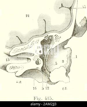 "Traité d'anatomie humaine. , Et par conséquent fait Office depoulie de rétlexion. C-C 1 K C 0.X V É a E-X C E La circonférence de la Caisse du Tympan, qui sépare à Leur périphérie et les Deux paroisexterne interne que nous venons de Décrire, est très irrégulière, fortement accidentée. Nousla diviserons en quatre Parties, nebenklägerin supé-inférieure rieure, nebenkläger, Partie antérieure, nebenklägerin postérieure, qui peuvent être considé - rées chacune comme une nouvelle paroi dela Caisse. Nous décrirons successivement Cha-- Mccune de ces Parteien: V Partie supérieure paroi supérieureou crânienne. - La paroi sup Stockfoto