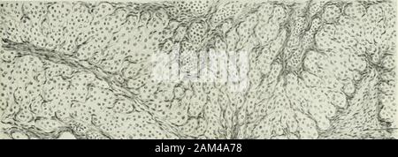 Handbuch der Physiologie des Menschen. Eierstock einer geschlecktsreifen Person. Älteres Corpus luteum. Vergr. 3/,. Abb. , 32.. Stockfoto