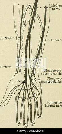 Medizinische und chirurgische Therapie. lludial Nerv. Ulnaris. -? Ulnaris.. Mittlere nerv Ulnaris (Tiefe brancli). Ulnare nerveCsuperticial Branch) j. J^Almar col - seitliche Nerv. Abb. 1 (5. - die Nerven des Arms. Abb. 17. - die Nerven des Unterarms und der Hand. In den Arm folgt die interne Grenze der Bizeps, der itback gegen die Positionen anticus. Es gibt keine Muskeln auf itsinner Seite, esj) ecially in Personen, deren Muskeln nicht welldevelo sind]) Ed. Diese innere Seite entspricht der A. brachialis aponeurosisand Haut. An der Biegung der Winkelstück der mittleren Nervs verlässt den brachialartery und übergibt zwisch Stockfoto