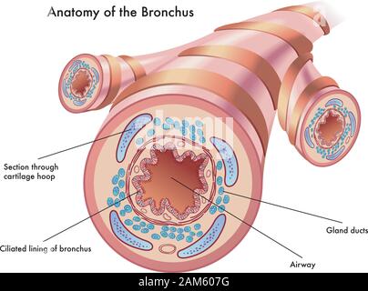 Medizinische Darstellung der Anatomie des Bronchus. Stock Vektor
