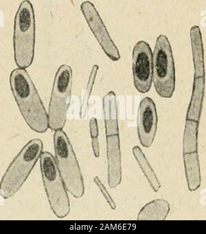 "Traité pratique de bactériologie. (Centralbl. furBakt., XXlU, 1898, S. 913). BACILLUS SPOROGENES ENTERITIDIS. 47 nent simplement au point une tuméfaction dinoculation. Cette tumé-Fraktion noch Dure et disparaît peu à peu, ou devient fluctuante etdonne Ausgabe à du liquide séreux. Ce Bacille paraît très répandu. Klein la en outre trouvé abondantdans les Eaux dégout, les Eaux de Rivières souillées, dans le fumier decheval, dans les poussières de Rues, la terre Cultivée; il La trouvé enplus dans une seconde épidémie de diarrhée, Mais jamais dans le Con-Tenu herum intestinale de lhomme Sain. Metschnikoff Stockfoto