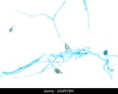 Nicht identifizierte Form unter dem Mikroskop, Hyphae und Sporen, horizontale Sicht beträgt etwa 121 Mikron Stockfoto