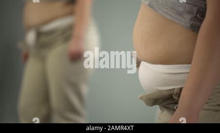 Fetter weiblicher Bauch mit Stretchspuren, kann aufgrund von Fettleibigkeit keine engen Hosen knopffnen Stockfoto