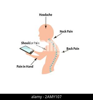 Falsche Körperhaltung Symptome. Text Hals Syndrom. Krümmung der Wirbelsäule, Kyphose, Lordose, Skoliose, Arthrose. Falsche Körperhaltung und Bücken. Infografiken Stock Vektor