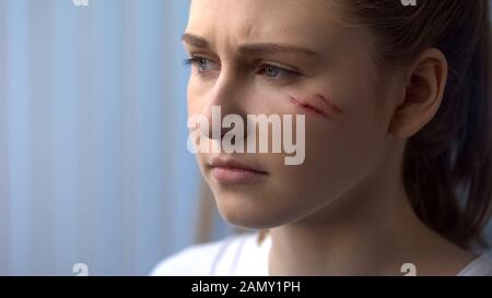 Gesicht des verärgerten jungen Mädchens mit Narben auf Wange, erste Hilfe nach Trauma, Behandlung Stockfoto