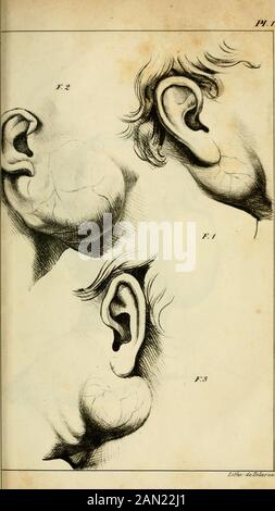 Maladies de la glande parotide et de la Région parotidienne : opérations que ces maladies Réclament. Perficiels Id. Abschnitt IL - Tumeurs formées par les ganglions lymphatiques. 262Abschnitt III - Tumeurs inflammatoires et abcès de la Région parotidienne 285 Abschnitt IV - Tumeurs de nature diverse 294 Art. 1er. Tumeurs Fibro-graisseuses Id. Art. 2. Tumeurs mélaniques, 296 Art. 5. Concrétions et poches salivaires .. 289 Art. 4. Kystes 501 Art. 5. Tumeurs anévrysmales 302 Art. 6. Tumeurs érectiles 307 Art. 7. Hypertrophie de la parotid Id. Listen des auteurs dont les observations sont condugée Stockfoto