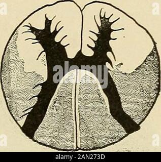 Organische und funktionelle Nervenkrankheiten; ein Textbuch der Neurologie . Abb. 167. Stockfoto