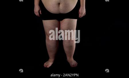 Übergewichtige Männer Beine auf dunklem Hintergrund, Gesundheitsprobleme, Unsicherheit, Krankheit Stockfoto