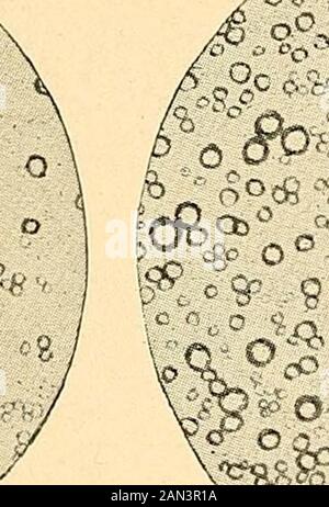 Moderne Diagnose und Behandlung von Krankheiten der Kinder; eine Abhandlung über die medizinischen und chirurgischen Erkrankungen der Kindheit . Stockfoto