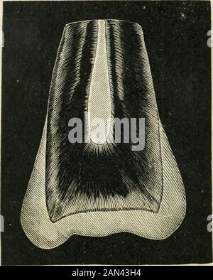 Transaktionen der Illinois State Dental Society, 1892 . Platte v.First Molars, Superior und Inferior. Platte VI. Zweite Molaren, Superior und Inferior. 118 ILLINOIS STATE DENTAL SOCIETY. Die Kronen aller Zähne oder jener Teil über der Ingivalline sind mit dieser Substanz bedeckt und geschützt, die als Email bekannt ist, beginnend mit einem dünnen Rand an der Zahnfleischlinie. Platte VII.Sektion von Superior First Bicuspid. Buccal View (3 Zoll Objektiv). Stockfoto