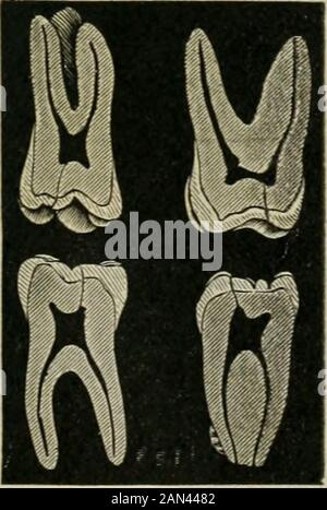 Transaktionen der Illinois State Dental Society, 1892 . Platte II. Erste Bicuspide, Superior und Inferior. Platte I.Second Bicuspids, Superior und Inferior. Allgemeine Form, während die Schneidezähne und Höcker in dieser Ansicht die Form der Zapfen vorführen, ihre Basen rootward dargestellt, wobei sie sich mit thekonischen Wurzeln an oder etwa dem freien Rand des Zahnfleischs vereinen. Siehe PlattenI. Bis einschließlich VI... Stockfoto