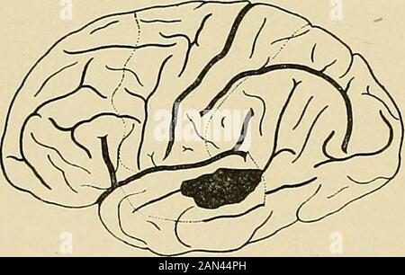 Organische und funktionelle Nervenkrankheiten; ein Textbuch der Neurologie . (Eichhorst.) (Claus.). Stockfoto