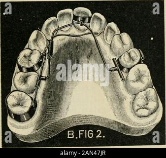 Transaktionen der Illinois State Dental Society, 1892 . 96 ILLINOIS ZUSTAND ZAHNMEDIZINISCHE GESELLSCHAFT. Stockfoto