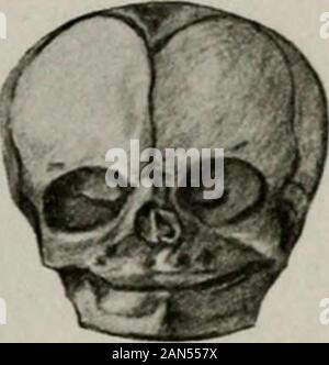Pflege und Ernährung von Säuglingen und Kindern; ein Text-Buch für ausgebildete Krankenschwestern. Abb. 3.-Sku.; von Erwachsenen. Abb. 4.-Schädel des Kindes. Anschließend sehr anfällig für Veränderungen in der Form. Da das Gesetz ofbreathing ist abhängig von der Aktion der Muskeln in elevat -. Stockfoto