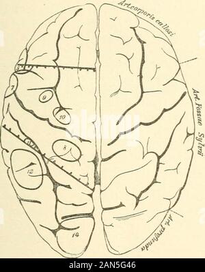 Handbuch der Wahnsinn für Praktiker und Studenten. Abb. 4. Rede und Schreiben (die in einer Gehirnhälfte allein entwickelt) sind nicht in unserem centio enthalten - Motor der Region, der merelyschematic Wert der Division erweist; trotzdem diese beiden wichtigen KORTIKALEN ZENTREN. 11 Zentren befinden sich in unmittelbarer Nähe zu dieser Region. Für Zwecke ofteaching wir eine scharfe Trennung der Zentren, die inreality oft in einen anderen Pass benötigen. Die Rede - Region, insbesondere muss als Composite kortikalen Region angesehen werden. Nur den eckender Rede-Region durch ihre Zentren gebildet werden, während die Corti - cal Stockfoto