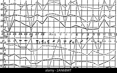 Die Keimbildung von der unberührten Atmosphäre. / 9 J 20-2/Abb. 91. - Schaubilder mit aktuellen nucleations, etc., 26. November bis Februar 21. . Keimbildung auf Block Island. I05 und Veränderung von Wind nach Norden. Die Maxima des 18 Hinter den Rest, aber die Messwerte fallen in Schritt am nächsten Tag. Der OIncrease sunshinelon Januar 1 zeigt ^ ihre Wirkung auf die Keimbildung, i - 1 - 1 - 1 - 1 - 1 - 1 - 1 1 1 r • i i J, 1R1 - R1 I 1 1 1 1 3 r 1 1 1 1 1 soPM - - - - 1 - - - I1 I I1 aftfis ft 1 a I 1 1 5. ft. 14 - 15 16 17 19 20 21 2 % 23 U 25 26 27 28 29 ALSO 3/lJtf *.2 Stockfoto