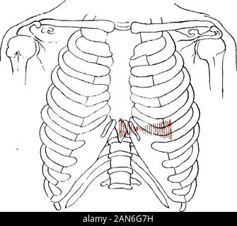 Die Anzeichen für interne Krankheiten, mit einer kurzen Betrachtung der wichtigsten Symptome. racticable und in jedem Fall ist äußerst schwierig. Therarity des einen mit der Frequenz des anderen affordsample Gründen gegenüber für Fehler, wenn nicht für entschuldigen. Die stärkste differential Punkt ist, dass die vaskuläre phenomenaaccompanying Aorteninsuffizienz, in der Lungenerkrankung abwesend sind. Pulmonalstenose, auch angeborene, wird durch die Union der dasventil Segmente verursacht. Die Fälle werden gelegentlich in der vegeta- tionen sind die Ursache für die niereninsuffizienz und Stenose festgestellt (Shattuck). Thecongeni Stockfoto