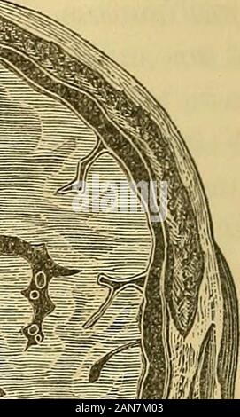 Eine praktische Abhandlung über die Krankheiten des Ohres einschließlich der Anatomie der Orgel. Stockfoto