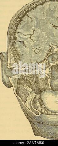 Eine praktische Abhandlung über die Krankheiten des Ohres einschließlich der Anatomie der Orgel. Die Eustachische Röhre, wie die externe auditorischen Meatus, besteht aus einem knöchernen und knorpeligen Teil. Die forinei. Stockfoto