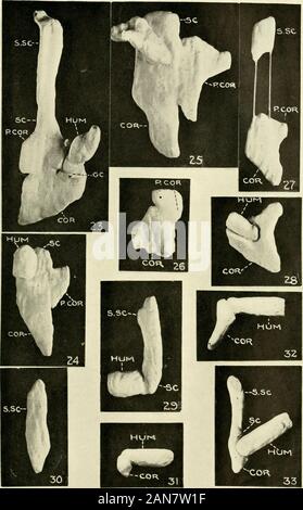 Die Zeitschrift für experimentelle Zoologie. der rechten Schulter Gürtel der einzelnen Ext. Gr. C.13 entwickelt, die in Abwesenheit der betreffenden Rudiment des ventralen Zone (mit Feigen vergleichen. 11 und 12). Abb. 30 Modell der rechten suprascapula einzelner Extern Gr. C.25 entwickelt, die in Abwesenheit der betreffenden Extremität und der Rest der Gürtel (withfig vergleichen. 13). Abb. 31 Modell sehr fragmentarischen Gürtel entwickelt, alongwith der Extremität, von der die Implantation eines kleinen Bereich von Zellen aus thedorsal Teil der Extremität Disc (mit Bild vergleichen. 14). Abb. 32 Modell eines implantierten Gürtel von indiv Stockfoto