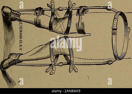 Vorträge über die physiologischen Gesetze des Lebens, Hygiene, und einen allgemeinen Überblick über die Krankheiten, die speziell für Frauen. . St., Indianapolis, Indiana. Es aremany Orte in den Vereinigten Stateswhere verformt Pro-Söhne verkrüppelt oder chirurgischen appliancesat vernünftige Zahlen, und nicht R.C.Davis xfe werden Söhne,,-. . ,,., Steife Knie- und Hüftgelenk humbugged in zahlende exnorbit-ant Preise für schlecht constructedand unsachgemäßer Einbau Instrumente. Ich nehme pleasurein empfehlen George Tiemann & Co., 67 Chathamstreet, New York, und der Orthopädischen Klinik atPhiladelphia, den Vorsitz in der Lage, Chirurgen, und Stockfoto