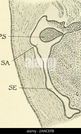 Myome und alliierten Tumoren (Myome und adenomyoma): ihre Pathologie, klinische Merkmale und chirurgische Behandlung. il^^^ fc*. Ich^^^^^^^Ich^^ u ^^;^:: vMr4.fm^u Stockfoto