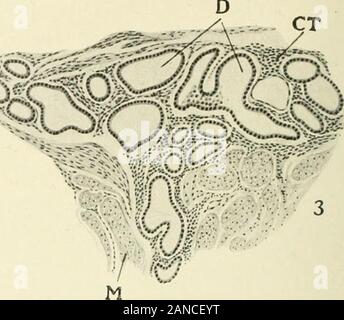 Myome und alliierten Tumoren (Myome und adenomyoma): ihre Pathologie, klinische Merkmale und chirurgische Behandlung. il^^^ fc*. Ich^^^^^^^Ich^^ u ^^;^:: vMr4 Stockfoto