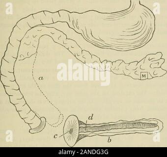 Transaktionen - American Surgical Association. Art und Weise. Diese Methode eine per-manent pankreatischen Fistel, der Abfluss aus dem INDI - cate die Menge der Sekretion von der unabhängigen Teil der thegland. Experiment XXIX. - Junger Hund; Gewicht, 30 lbs. Ligatedpancreas an der Kreuzung Mitte mit distalen Teil, Abschnitt Der glandimmediately unter Ligatur, die Trennung von unabhängigen Teil fromduodenum im Umfang von zwei Zoll, Implantation von freien Ende in die CHIRURGIE DER BAUCHSPEICHELDRÜSE. 145 Der untere Winkel der Bauchschnitt mit vier catgut Naht. Während des zweiten Tages, leichter Anstieg der Stockfoto