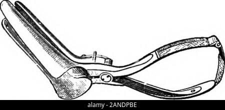 Eine bebilderte Medizinische encyclopaedic dictionaryBeing ein Wörterbuch der technischen Begriffe von Schriftstellern auf die Medizin und die Sicherheiten, in der Latein, Englisch, Französisch und Deutsch. NOTESS VERBESSERTE AUGE SPECULUM.. ALSTONS 3-ELADED EBCTAL SPECULUM. Stockfoto