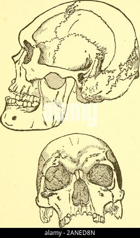 Ort des Menschen in der Natur und anderen anthropologischen Essays. inreality, der extreme Ausdruck einer Reihe führender graduallyfrom auf die Höchsten und Besten entwickelt von humancrania. Auf der einen Seite, ist es eng genähert durchdie abgeflacht Australische Schädel, von denen ich gesprochen habe, aus denen andere australische Formen führen uns zu graduallyup Schädel mit sehr viel den Typ des Engiscranium. Und auf der anderen Seite ist es auch moreclosely affined auf die Schädel einiger alten Leute whoinhabited Dänemark während der Stein, andwere vermutlich entweder gleichzeitig mit oder laterthan, die Macher von t Stockfoto