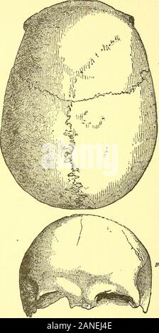 Ort des Menschen in der Natur und anderen anthropologischen Essays. f Die occipitalbones, soweit die Mitte des occipital Foramen, isentire, oder fast so. Die linke Felsenbein ist Avanting. Der rechten zeitlichen, die Teile in der unmittelbaren Wiehern - bourhood des auditiven Foramen, das Mastoid Prozess, und ein erheblicher Teil der squamous Element des Zeitlichen sind gut erhalten (Abb. 23). Die Linien der Bruch, der zwischen dem coad bleiben - bereinigt Stücke der Schädel, und getreu in Schmerlings Abbildung, sind leicht nachvollziehbar in der Besetzung. Die Nähte auch erkennbar sind, aber der c Stockfoto