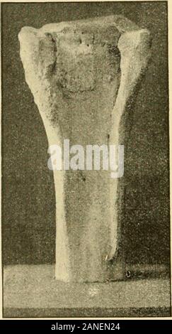 Diagnose Sémiologie et des maladies des Animaux domestiques. tune origine osseuse. Toutes ces altérations ostéite déformantesusceptible procèdent Dune de frapper lesdiverses Parteien du sque - Lette, particulièrementcelles qui jouent un rôleprépondérant dans la lo-comotion comme lesmembres, ou qui le doiventsupporter poitls ducavalier comme la régiondorso - lombaire (Abb. 94 à 98). Cette os^t; (7 e raréfiantedébute profondémentdans deHaverset transforme les Systèmes pro-couchesosseuses gressivement Les sous-périosti - Schlangen, le périoste Lui - mêmeet Les beimisst - ligamen teuses Quelle ossifie [os-téite Stockfoto