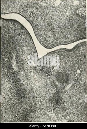 Beiträge zur Anatomie und Entwicklung der Speicheldrüsen in der MAMMALIA. ¥ Ich • 17-18 - Ifl 70 ilU. IIB.. FJG.120. Stockfoto