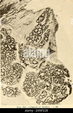 Grundsätze und Praxis der Operative Zahnheilkunde. Abb. 202.-Oblique Abschnitt der zahnmedizinischen Follikel und Schleimhaut. (V. A. Latham.) 20.. landet von Serres. X50. Stockfoto