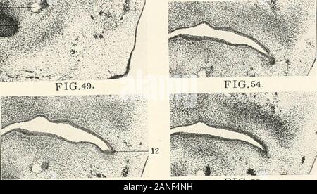 Beiträge zur Anatomie und Entwicklung der Speicheldrüsen in der MAMMALIA. ra-. f-^r --^-------. ???? ??? • An? Abb. 53. Stockfoto