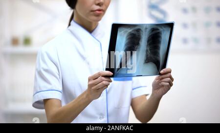 Weibliche Arzt aufmerksam Lungen Röntgen, Gefahr von Bronchitis suchen, Gesundheit Stockfoto