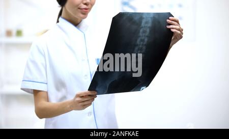 Weibliche Chirurg an der Wirbelsäule x-ray suchen, gerne mit Patienten Prüfung Resultat Stockfoto