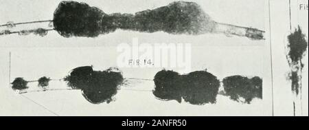 Annalen der Tropenmedizin und Parasitologie. V • V - 11 Der TRICHONOCARDIASES/1^?^^^l litJ firenz/ffsB^ fii^^ ich S. Crece Pt! Annalen Trap. Msd. & ParasitoL, Vol. VII PLATTE XXXVII Fie. 13.. Abb. l 5,- V FiglZ li" ii*^ il^^-V Stockfoto