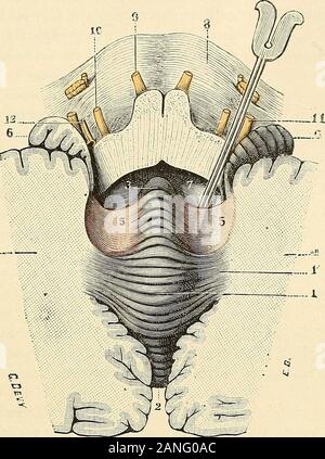 "Traité d'anatomie humaine. Érance annulaire. - Ich. bulbe racbidicn, forlemcut érigné enliaul. - 3, der Stufe quatrième ventricule. - 4, 4, hémisphères cérébelleux. - Ï, vermis inférieur. - (Ich. luette. - 7, 7 valvules de Tarin. - 8. lobulesdu pneumogastrique. Iati-! Ich, 0, Oberflächen des Deux Abschnitte qui oui été]) - Gießen quécs lablation des amvgdales. - V, Racines du trijumeau. - Viii, Racine posiérieure rli landilif. CERVELET 527 Stufen Moyen (Abb. 402 et 403), prolongements séchappent Deux à Richtung transver-Verkauf, qui et plongent disparaissent dans chacun lhémisphère Correspondant. Laportion du vermis qu Stockfoto