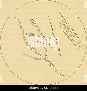 Forschungen auf das Gift der Klapperschlange: mit einer Untersuchung der Anatomie und Physiologie der Organe. Ein, Epithelzellen der Hauptkanal und der Buchse an der Unterseite der Drüse; 6, Pigment-Zellen des Kanals. Abb. 9.. Nicht-STKIATED MdSCULAB FiBEE-ZELLEN DES SCHLIESSMUSKELS OP des Kanals. Auf caieful Prüfung der Natur dieses Gewebes, ich fand Es formedby eine Steigerung in Höhe von fibrösem Gewebe, und durch den Zusatz von einer Schicht von OP DAS GIFT DER KLAPPERSCHLANGE. 15 längliche fusiform Zellen, Abb. 9, die jeweils einen einzelnen Kern, und manchmal eine lange, dunkle nucl Stockfoto